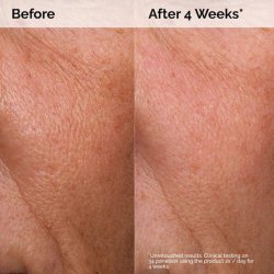 سرم آبرسان هیالورونیک اسید 2% + B5 اوردینری حجم 30 میلی لیتر